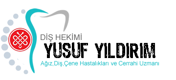 Adıyaman Diş Hekimi Dt. Yusuf YILDIRIM | İmplant Uygulamaları